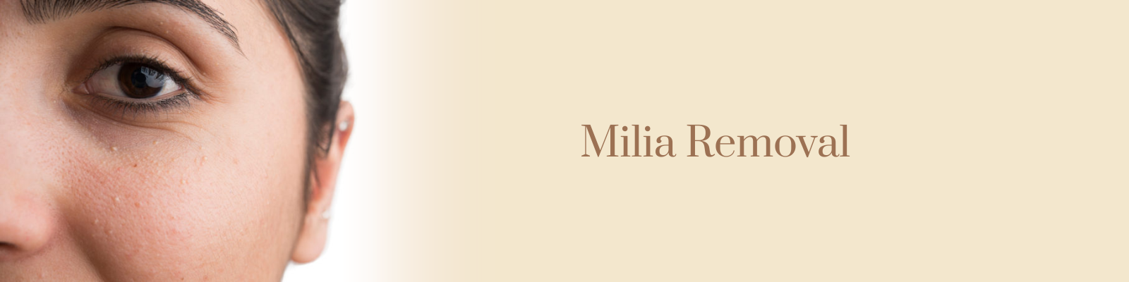 Milia Removal Treatment in Delhi