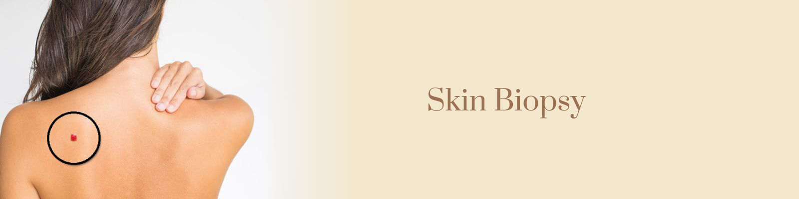 Skin Biopsy Treatment in Delhi