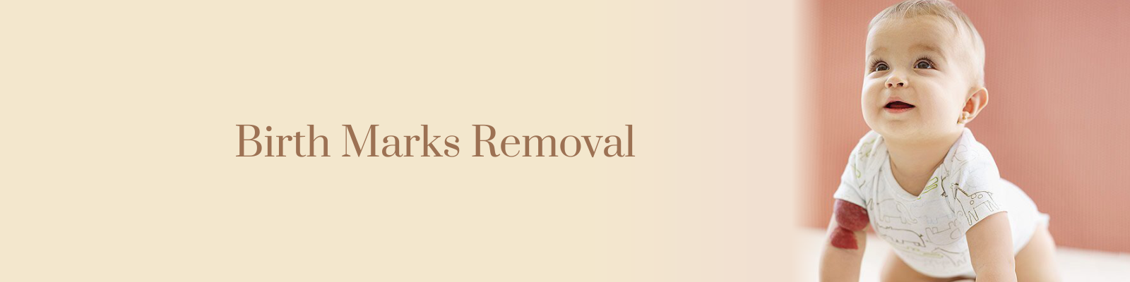 Birth Mark Removal Treatment in Delhi