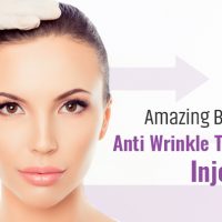 Everything You Need to Know About Anti Wrinkle Treatment