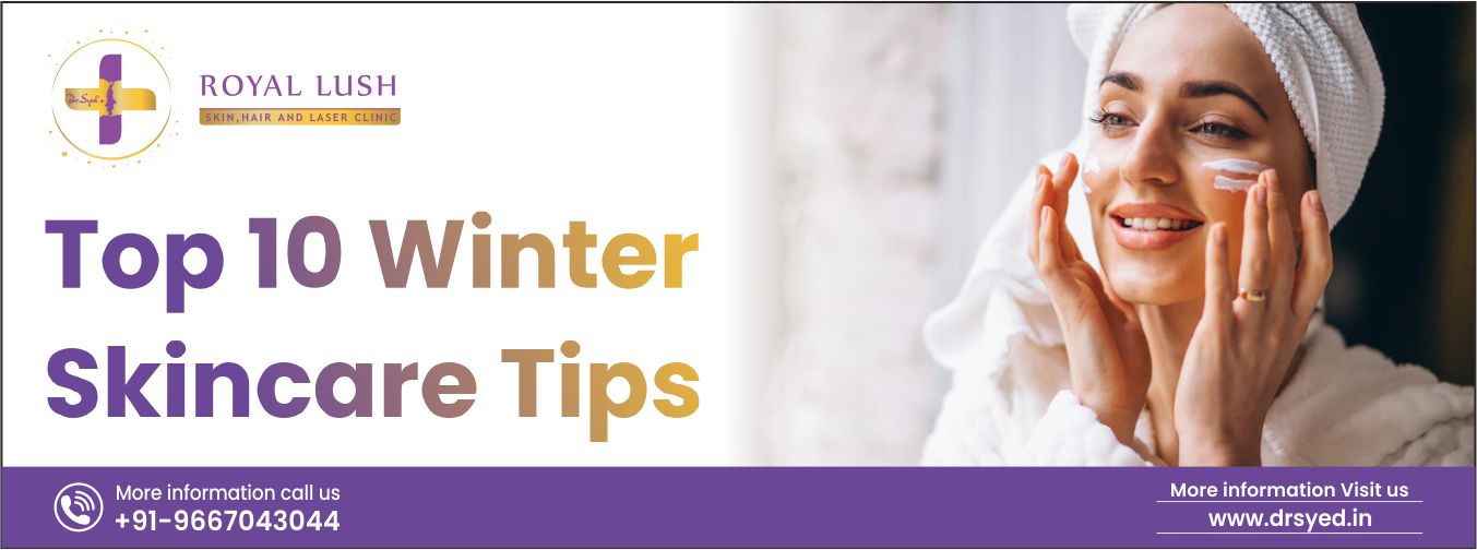 how-to-avoid-dandruff-in-winters