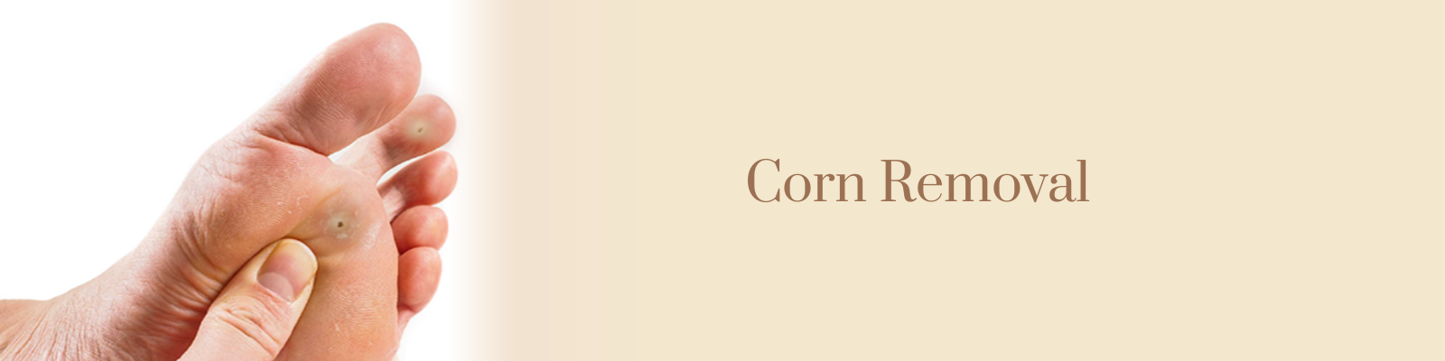corn removal in south delhi