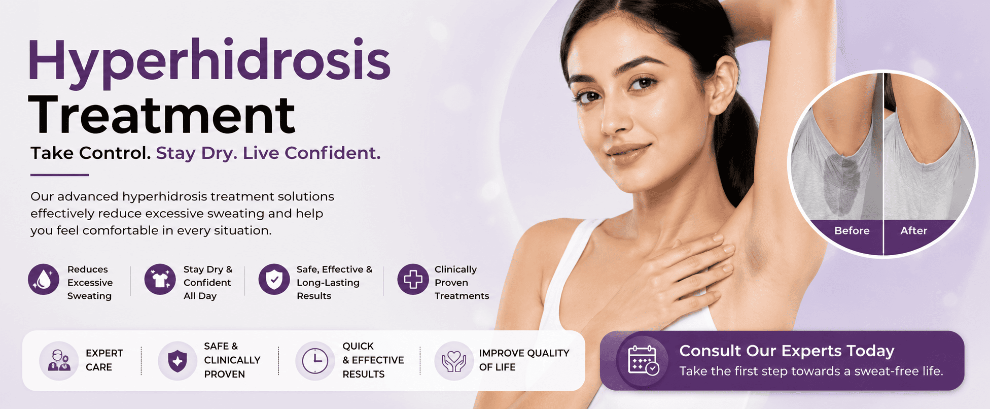 Hyperhidrosis