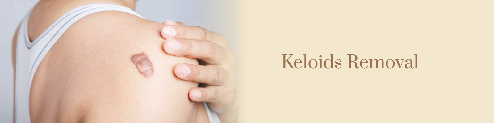 Keloids Treatment in Delhi