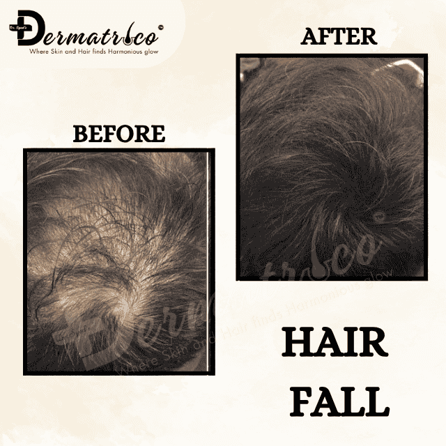 skin-clinic-near-okhla-delhi