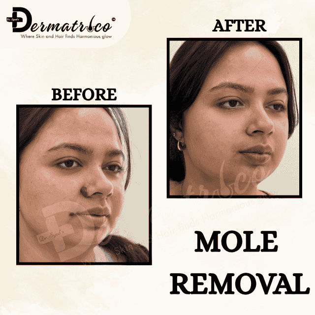 skin-clinic-near-okhla-delhi