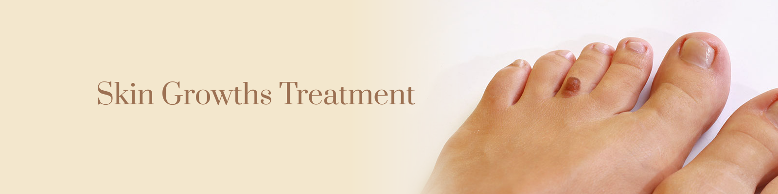 Skin Growth Treatment in Delhi