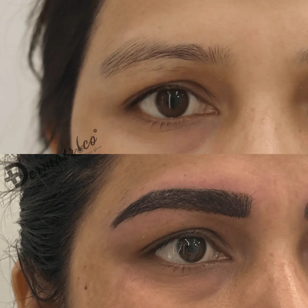 Enhance Your Brows with Microblading!