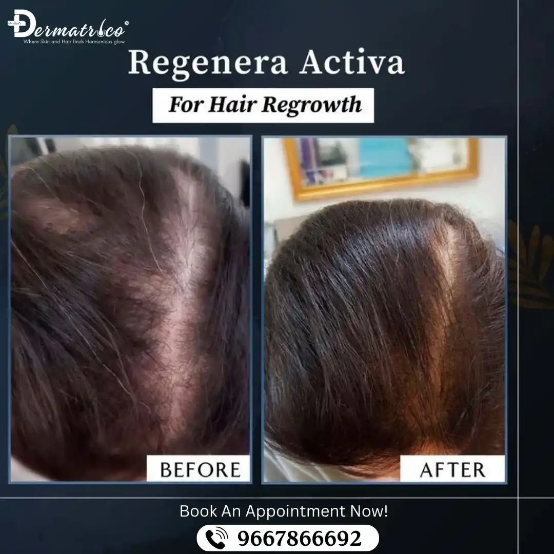 What is Regenera Activa?