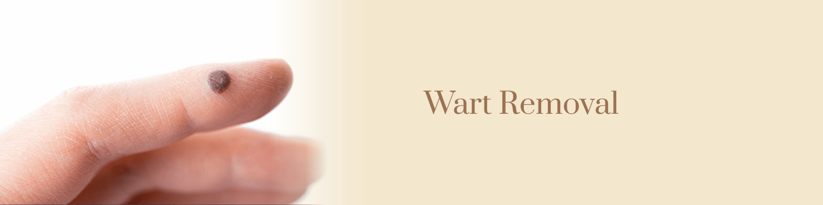 Wart Removal Treatment in Delhi
